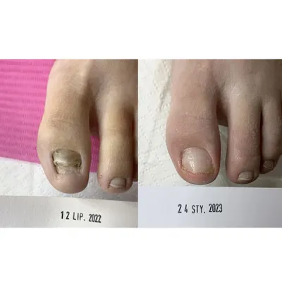 PODOLOG ŚLĄSK - Zabrze